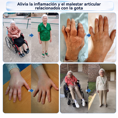 👩‍⚕️𝗜𝑭𝑴𝑨𝑮𝑰𝐶®🚢 𝑨𝒍𝒑𝒊𝒏𝒆 𝑩𝒐𝒕𝒂𝒏𝒊𝒄𝒂𝒍 𝑷𝒂𝒓𝒄𝒉𝒆 𝑫𝒆 𝑴𝒊𝒄𝒓𝒐𝒂𝒈𝒖𝒋𝒂𝒔 𝑷𝒂𝒓𝒂 𝑨𝒓𝒕𝒊𝒄𝒖𝒍𝒂𝒄𝒊𝒐𝒏𝒆𝒔