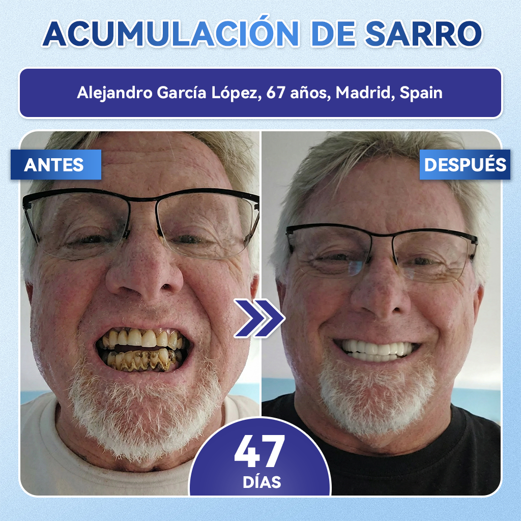 𝐆𝐥𝐢𝐦𝐦𝐞𝐫𝐥𝐲®😁🦷𝐓𝐢𝐝𝐞𝐠𝐥𝐮𝐬𝐢𝐛 𝐃𝐢𝐞𝐧𝐭𝐞𝐬 𝐘 𝐄𝐧𝐜í𝐚𝐬 𝐑𝐞𝐩𝐚𝐫𝐚𝐫 𝐌𝐢𝐜𝐫𝐨𝐧𝐞𝐞𝐝𝐥𝐞 𝐏𝐚𝐫𝐜𝐡𝐞 |𝑇𝑖𝑟𝑎𝑠 𝑑𝑒𝑛𝑡𝑎𝑙𝑒𝑠 𝑐𝑜𝑛 𝑡𝑒𝑐𝑛𝑜𝑙𝑜𝑔í𝑎 𝑎𝑣𝑎𝑛𝑧𝑎𝑑𝑎 𝑑𝑒 𝑎𝑐𝑡𝑖𝑣𝑎𝑐𝑖ó𝑛 𝑑𝑒 𝑐é𝑙𝑢𝑙𝑎𝑠 𝑚𝑎𝑑𝑟𝑒