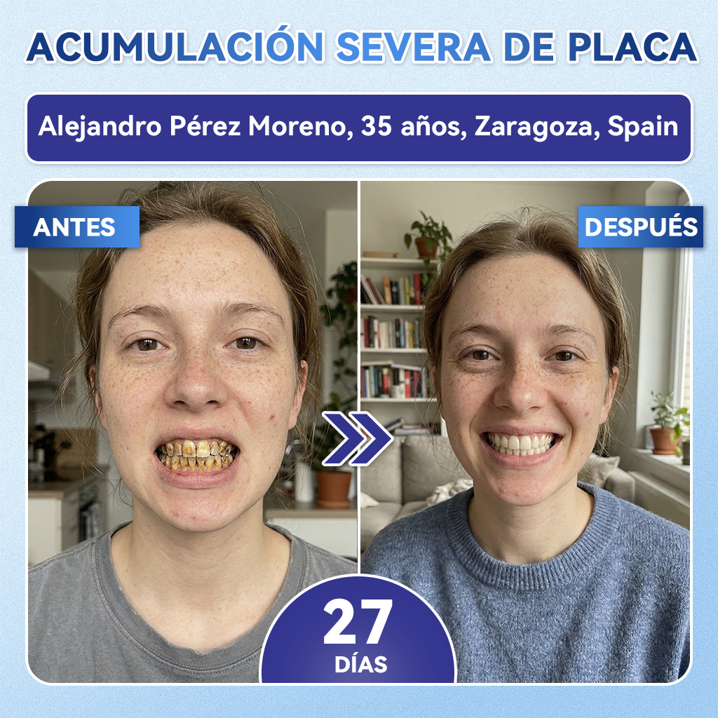 𝐆𝐥𝐢𝐦𝐦𝐞𝐫𝐥𝐲®😁🦷𝐓𝐢𝐝𝐞𝐠𝐥𝐮𝐬𝐢𝐛 𝐃𝐢𝐞𝐧𝐭𝐞𝐬 𝐘 𝐄𝐧𝐜í𝐚𝐬 𝐑𝐞𝐩𝐚𝐫𝐚𝐫 𝐌𝐢𝐜𝐫𝐨𝐧𝐞𝐞𝐝𝐥𝐞 𝐏𝐚𝐫𝐜𝐡𝐞 |𝑇𝑖𝑟𝑎𝑠 𝑑𝑒𝑛𝑡𝑎𝑙𝑒𝑠 𝑐𝑜𝑛 𝑡𝑒𝑐𝑛𝑜𝑙𝑜𝑔í𝑎 𝑎𝑣𝑎𝑛𝑧𝑎𝑑𝑎 𝑑𝑒 𝑎𝑐𝑡𝑖𝑣𝑎𝑐𝑖ó𝑛 𝑑𝑒 𝑐é𝑙𝑢𝑙𝑎𝑠 𝑚𝑎𝑑𝑟𝑒