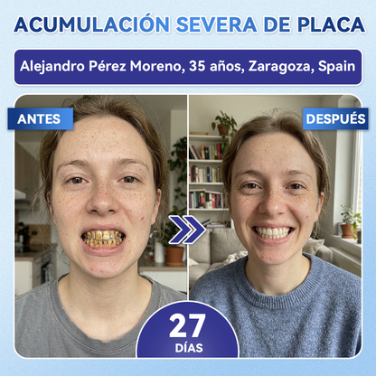 𝐆𝐥𝐢𝐦𝐦𝐞𝐫𝐥𝐲®😁🦷𝐓𝐢𝐝𝐞𝐠𝐥𝐮𝐬𝐢𝐛 𝐃𝐢𝐞𝐧𝐭𝐞𝐬 𝐘 𝐄𝐧𝐜í𝐚𝐬 𝐑𝐞𝐩𝐚𝐫𝐚𝐫 𝐌𝐢𝐜𝐫𝐨𝐧𝐞𝐞𝐝𝐥𝐞 𝐏𝐚𝐫𝐜𝐡𝐞 |𝑇𝑖𝑟𝑎𝑠 𝑑𝑒𝑛𝑡𝑎𝑙𝑒𝑠 𝑐𝑜𝑛 𝑡𝑒𝑐𝑛𝑜𝑙𝑜𝑔í𝑎 𝑎𝑣𝑎𝑛𝑧𝑎𝑑𝑎 𝑑𝑒 𝑎𝑐𝑡𝑖𝑣𝑎𝑐𝑖ó𝑛 𝑑𝑒 𝑐é𝑙𝑢𝑙𝑎𝑠 𝑚𝑎𝑑𝑟𝑒