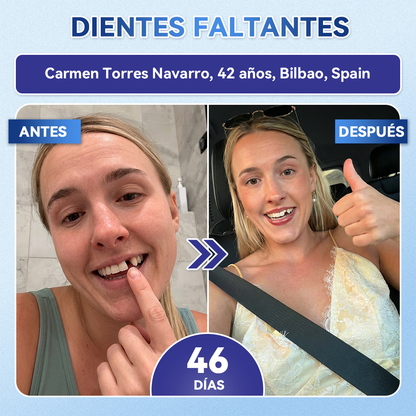 𝐆𝐥𝐢𝐦𝐦𝐞𝐫𝐥𝐲®😁🦷𝐓𝐢𝐝𝐞𝐠𝐥𝐮𝐬𝐢𝐛 𝐃𝐢𝐞𝐧𝐭𝐞𝐬 𝐘 𝐄𝐧𝐜í𝐚𝐬 𝐑𝐞𝐩𝐚𝐫𝐚𝐫 𝐌𝐢𝐜𝐫𝐨𝐧𝐞𝐞𝐝𝐥𝐞 𝐏𝐚𝐫𝐜𝐡𝐞 |𝑇𝑖𝑟𝑎𝑠 𝑑𝑒𝑛𝑡𝑎𝑙𝑒𝑠 𝑐𝑜𝑛 𝑡𝑒𝑐𝑛𝑜𝑙𝑜𝑔í𝑎 𝑎𝑣𝑎𝑛𝑧𝑎𝑑𝑎 𝑑𝑒 𝑎𝑐𝑡𝑖𝑣𝑎𝑐𝑖ó𝑛 𝑑𝑒 𝑐é𝑙𝑢𝑙𝑎𝑠 𝑚𝑎𝑑𝑟𝑒
